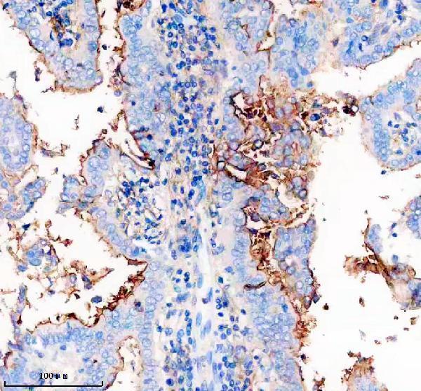 IHC analysis of ICAM1 using anti-ICAM1 antibody (M00171-1)
