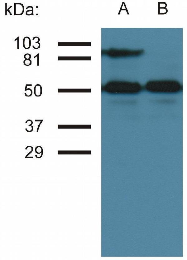 Western blotting analysis of CD54 expression in TNF-alpha activated (A) and nonactivated (B) HUVEC cells by antibody MEM-111
