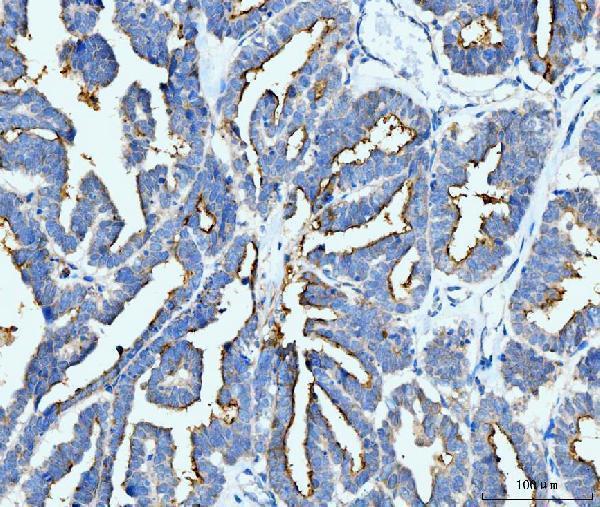  IHC analysis of ICAM1 using anti-ICAM1 antibody (M00171-3)