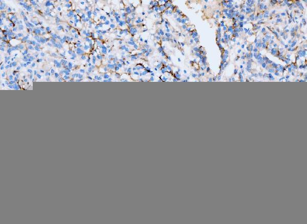  IHC analysis of ICAM1 using anti-ICAM1 antibody (M00171-3)