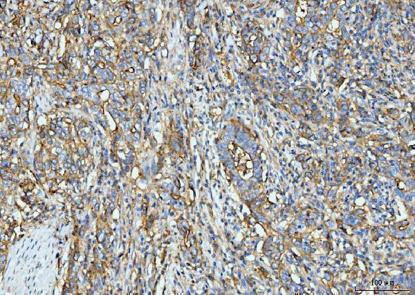 m00171 3 icam1 primary antibodies ihc testing 4