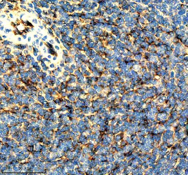 IHC analysis of ICAM1 using anti-ICAM1 antibody (M00171-5)