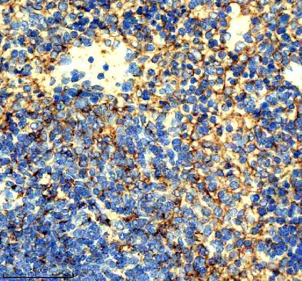 IHC analysis of ICAM1 using anti-ICAM1 antibody (M00171-5)
