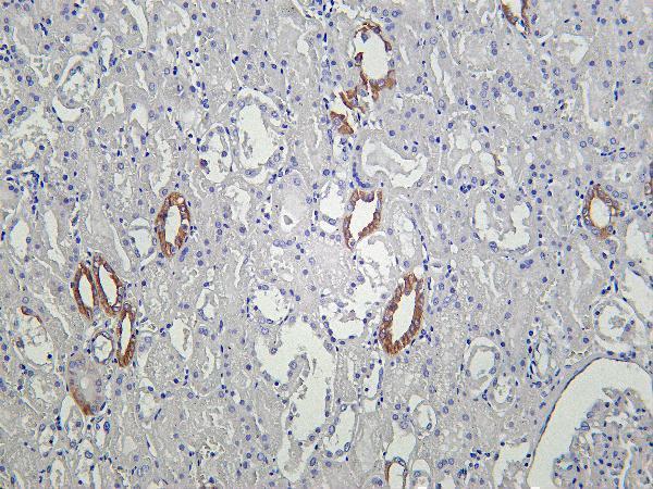 Human kidney was stained with Anti-ICAM1 rabbit antibody
