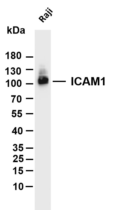 Various whole cell lysates were separated by 4-20% SDS-PAGE, and the membrane was blotted with anti-ICAM1 antibody