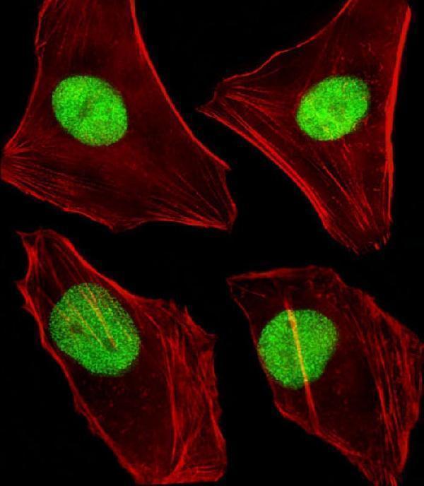 m00172 2 anti mouse dnmt1 antibody center if testing 1