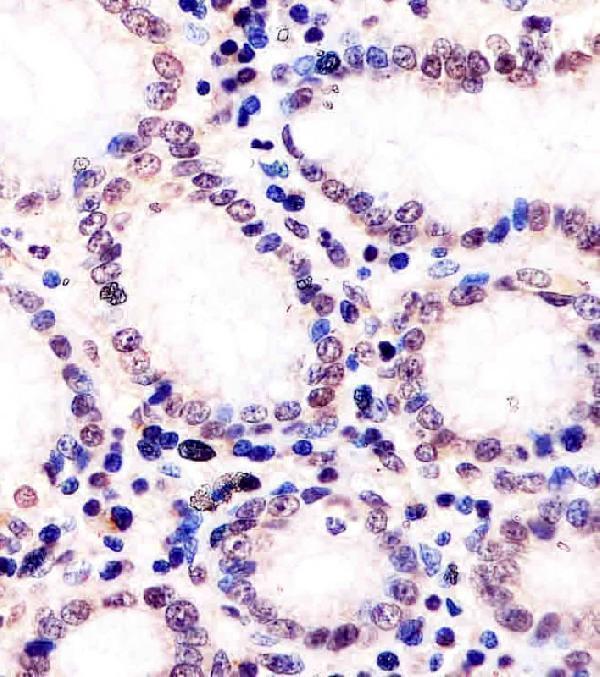 m00172 2 anti mouse dnmt1 antibody center ihc p testing 4