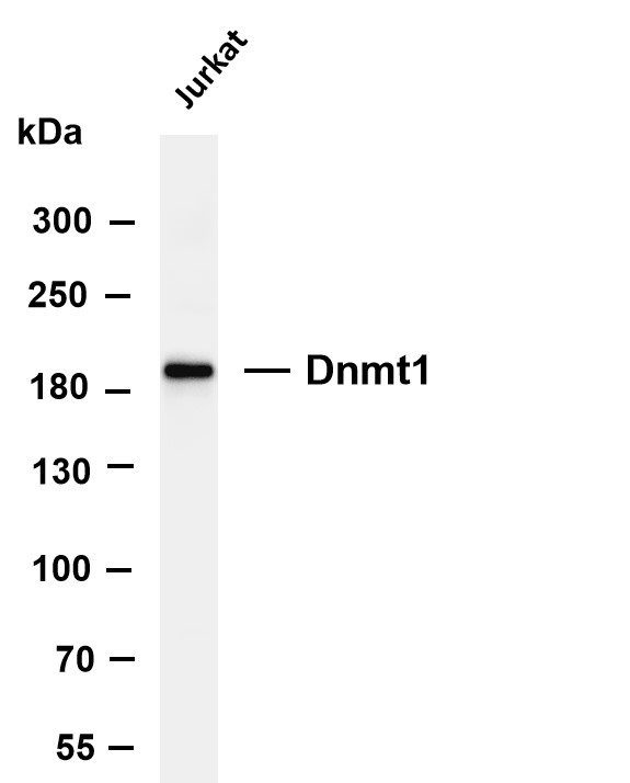 Various whole cell lysates were separated by 4-8% SDS-PAGE, and the membrane was blotted with anti-Dnmt1 antibody