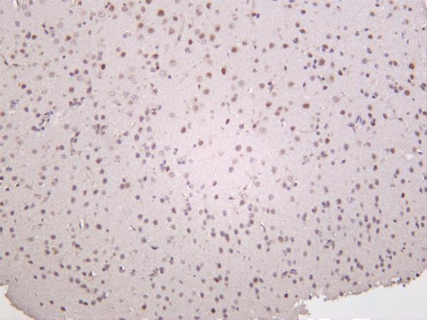 m00173 3 cdkn1b primary antibodies ihc testing 1