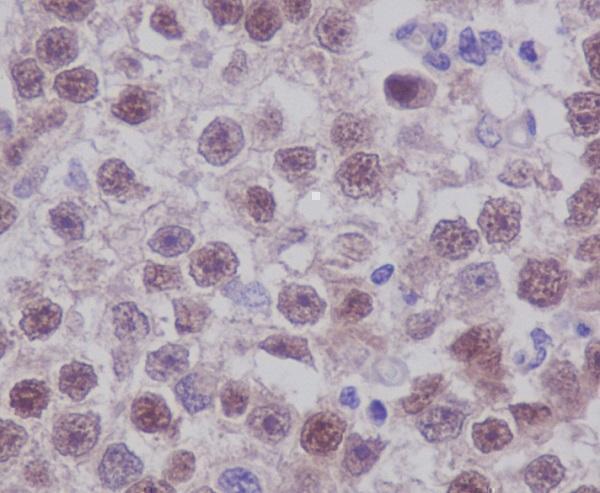 m00174 ihc