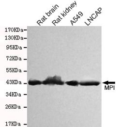 Western blot detection of MPI in Rat kidney, Rat brain, A549 & LNCAP cell lysates and using MPI antibody (1:1000 diluted) 