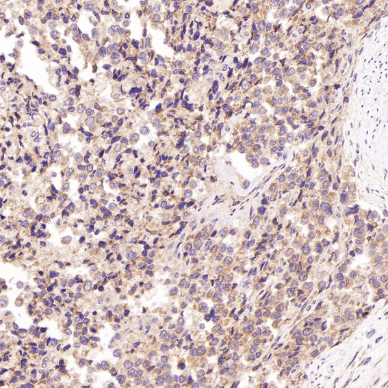 m00176 1 ihc8