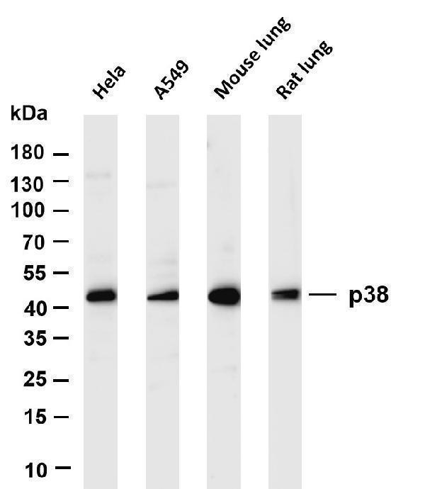 Various whole cell lysates were separated by 4-20% SDS-PAGE, and the membrane was blotted with anti-p38 antibody