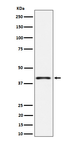 Western blot analysis of Phospho-p38 (T180) expression in HeLa treated with anisomycin cell lysate