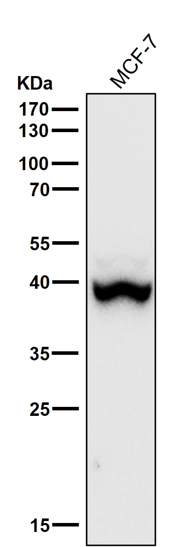 All lanes use the Antibody at 1:1K dilution for 1 hour at room temperature