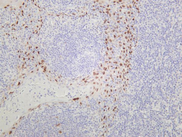 Human tonsil was stained with anti-SOX9 rabbit antibody