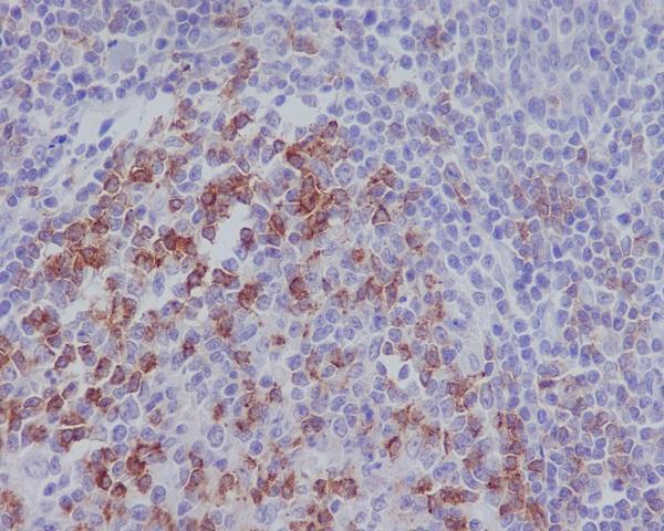 Immunohistochemical analysis of paraffin-embedded human tonsil, using PD1 Antibody  