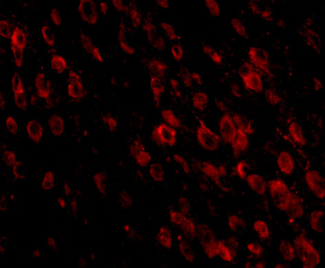 m00178 3 pdcd1 primary antibodies if testing 3