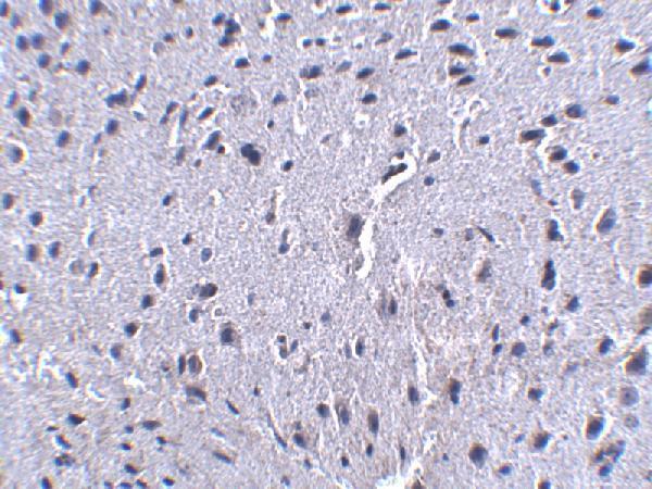 m00178 3 pdcd1 primary antibodies ihc testing 2
