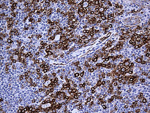 m00179 3 anti caveolin 1 cav1 mouse monoclonal antibody clone id oti2c4 ihc testing 4