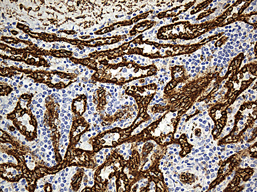 m00179 3 anti caveolin 1 cav1 mouse monoclonal antibody clone id oti2c4 ihc testing 5