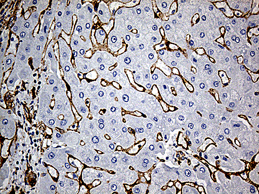 m00179 3 anti caveolin 1 cav1 mouse monoclonal antibody clone id oti2c4 ihc testing 6