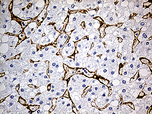 m00179 3 anti caveolin 1 cav1 mouse monoclonal antibody clone id oti2c4 ihc testing 7