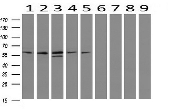 m00180 anti iduronate 2 sulfatase ids mouse monoclonal antibody clone id oti4g2 wb testing 2