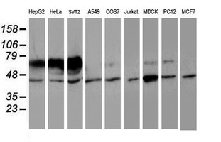m00180 anti iduronate 2 sulfatase ids mouse monoclonal antibody clone id oti4g2 wb testing 3