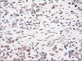 m00182 1 anti plk1 mouse monoclonal antibody clone id oti1d4 ihc testing 10
