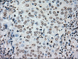 m00182 1 anti plk1 mouse monoclonal antibody clone id oti1d4 ihc testing 11