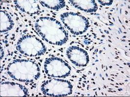 m00182 1 anti plk1 mouse monoclonal antibody clone id oti1d4 ihc testing 12