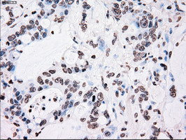 m00182 1 anti plk1 mouse monoclonal antibody clone id oti1d4 ihc testing 13