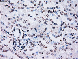 m00182 1 anti plk1 mouse monoclonal antibody clone id oti1d4 ihc testing 14