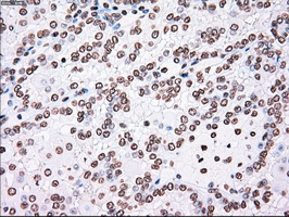 m00182 1 anti plk1 mouse monoclonal antibody clone id oti1d4 ihc testing 15