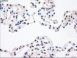 m00182 1 anti plk1 mouse monoclonal antibody clone id oti1d4 ihc testing 16