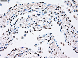 m00182 1 anti plk1 mouse monoclonal antibody clone id oti1d4 ihc testing 2