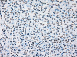 m00182 1 anti plk1 mouse monoclonal antibody clone id oti1d4 ihc testing 3