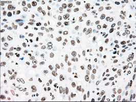 m00182 1 anti plk1 mouse monoclonal antibody clone id oti1d4 ihc testing 4