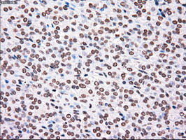 m00182 1 anti plk1 mouse monoclonal antibody clone id oti1d4 ihc testing 5