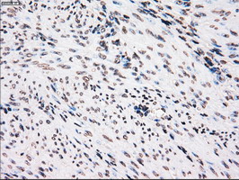 m00182 1 anti plk1 mouse monoclonal antibody clone id oti1d4 ihc testing 6