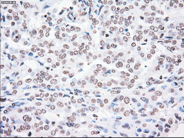 m00182 1 anti plk1 mouse monoclonal antibody clone id oti1d4 ihc testing 7