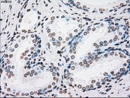 m00182 1 anti plk1 mouse monoclonal antibody clone id oti1d4 ihc testing 8