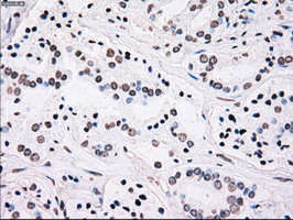 m00182 1 anti plk1 mouse monoclonal antibody clone id oti1d4 ihc testing 9