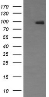 HEK293T cells were transfected with the pCMV6-ENTRY control (Left lane) or pCMV6-ENTRY NCAM1 (Right lane) cDNA for 48 hrs and lysed