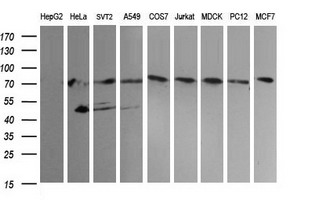 Western blot analysis of extracts (35ug) from 9 different cell lines by using anti-NCAM1 monoclonal antibody (HepG2: human; HeLa: human; SVT2: mouse; A549: human; COS7: monkey; Jurkat: human; MDCK: canine; PC12: rat; MCF7: human)