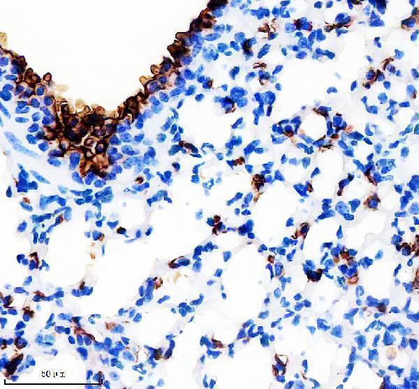 m00187 1 muc1 primary antibodies ihc testing 4