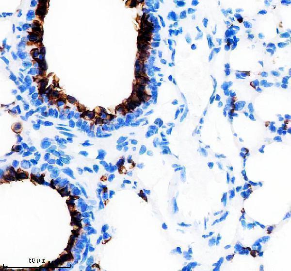 m00187 1 muc1 primary antibodies ihc testing 5