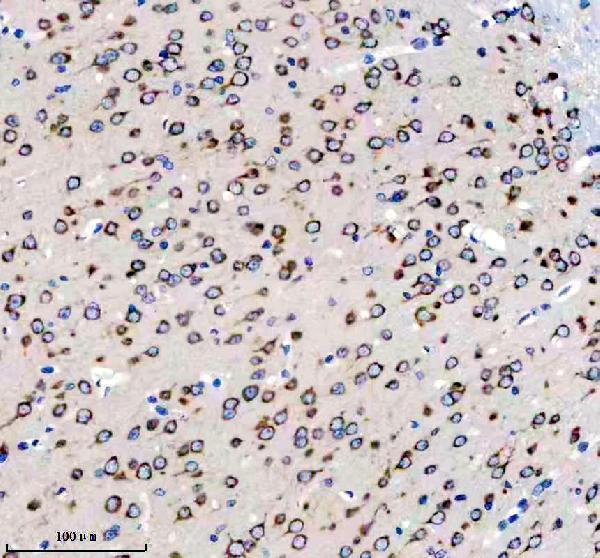 IHC analysis of FMR1 using anti-FMR1 antibody (M00192)