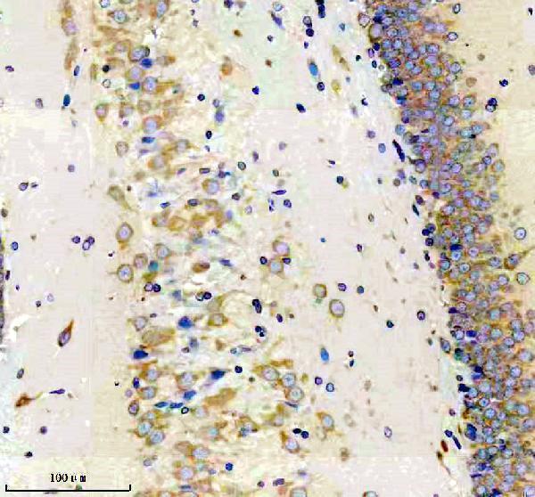 IHC analysis of FMR1 using anti-FMR1 antibody (M00192)